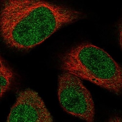 TADA3L Antibody, Novus Biologicals 25 &mu;L; Unlabeled:Antibodies, Polyclonal